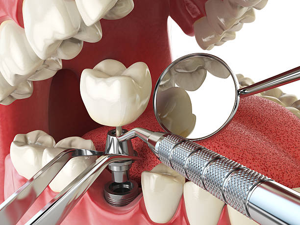 Best Emergency Broken Tooth Repair in Woodlawn, MD